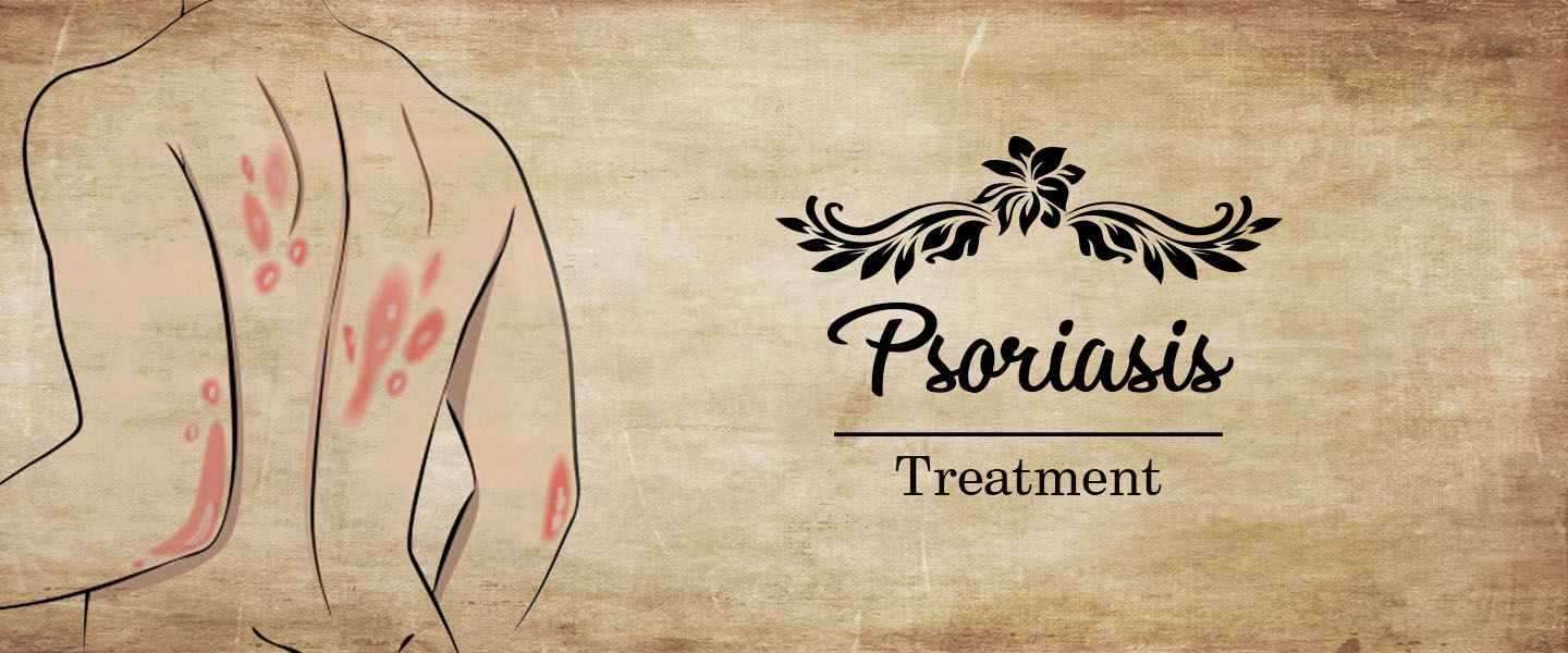 Ayurvedic Treatment For Psoriasis