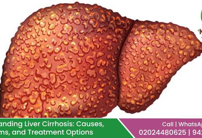 Liver Cirrhosis