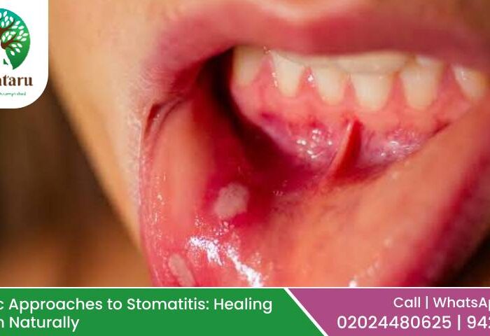 Stomatitis