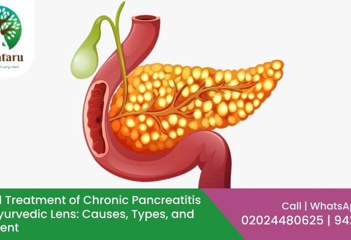 Chronic Pancreatitis