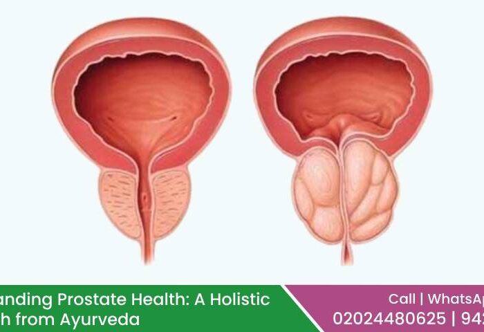 Prostate Health