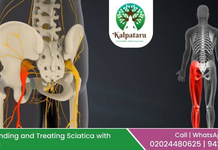 Sciatica