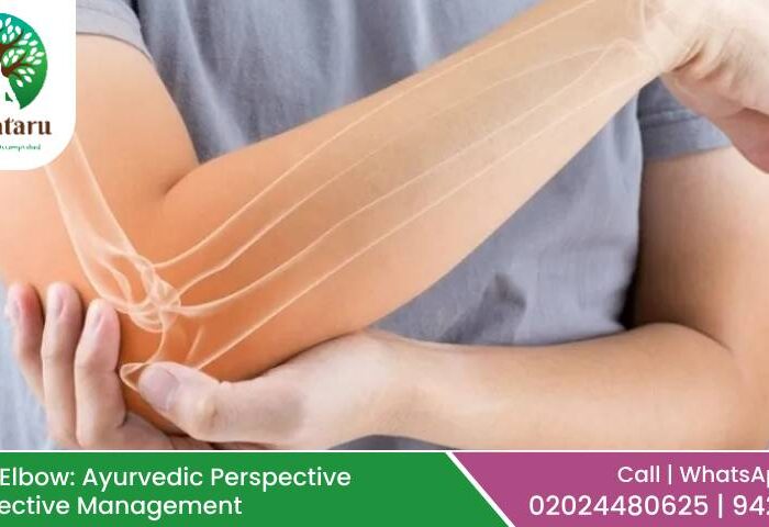 Tennis Elbow: Ayurvedic Perspective and Effective Management
