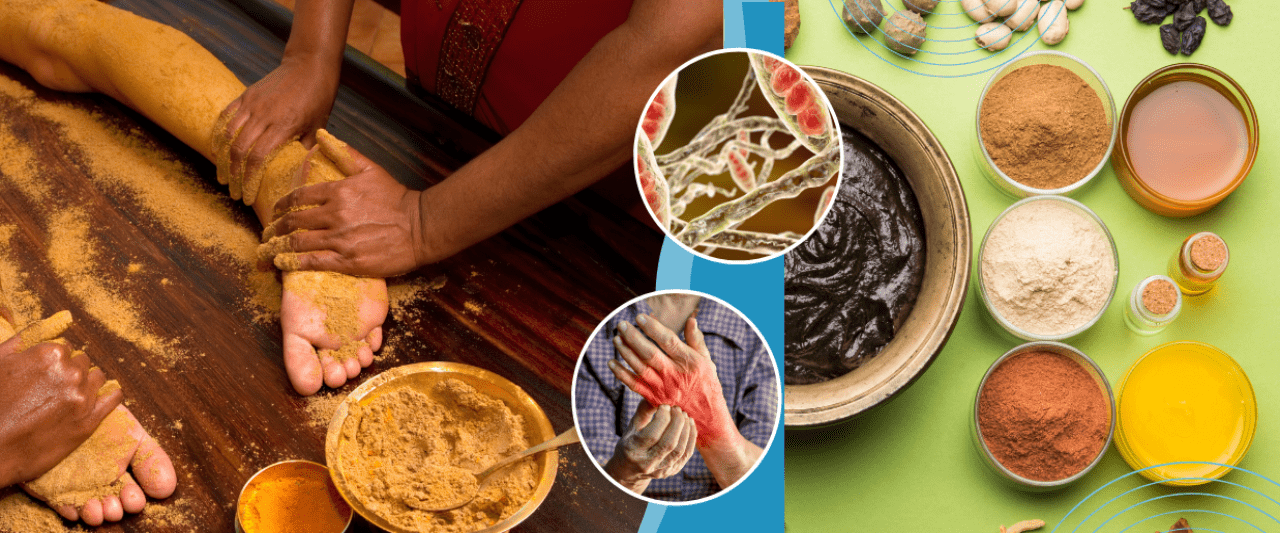 Best Ayurvedic Treatment For Fungal Infection in Pune- Dr. Manoj Deshpande