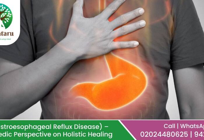 GERD (Gastroesophageal Reflux Disease) – An Ayurvedic Perspective on Holistic Healing
