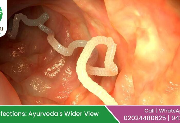 Ayurvedic treatment for worm infections (Krimi Roga) at Kalpataru Ayurvediya Chikitsalaya, Pune – safe herbal remedies, Panchakarma, and immunity care.