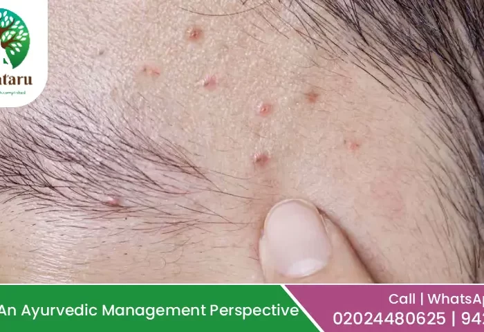 Ayurvedic treatment for folliculitis – natural remedies & skin care at Kalpataru Ayurved Chikitsalaya™