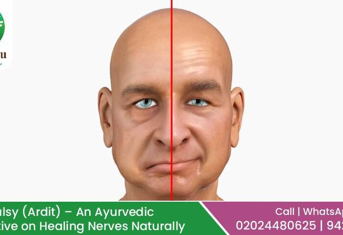 Ayurvedic Treatment for Facial Palsy | Best Ayurvedic Treatment for Facial Paralysis – Kalpataru Ayurvediya Chikitsalaya, Pune